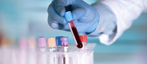 Evde kan alma hizmetinde hemşirenin steril tüplerle kan örneği aldığı ve etiketleme yaptığı bir sahne.