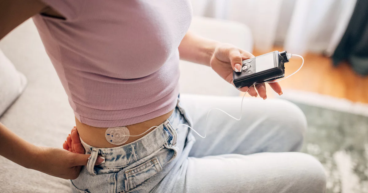 Şişli’de sağlık personeli tarafından hastaya ev ortamında idrar sondası takılması işlemi